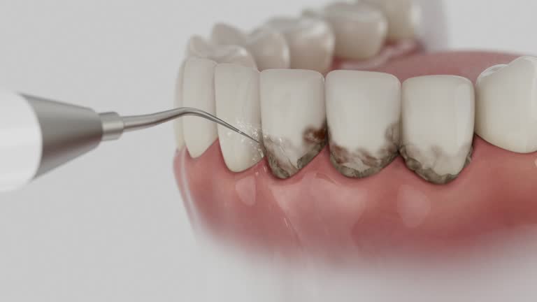 Reliable Teeth Cleaning And Checkup contractor in Campbell County County, SD by Dentist Open Now